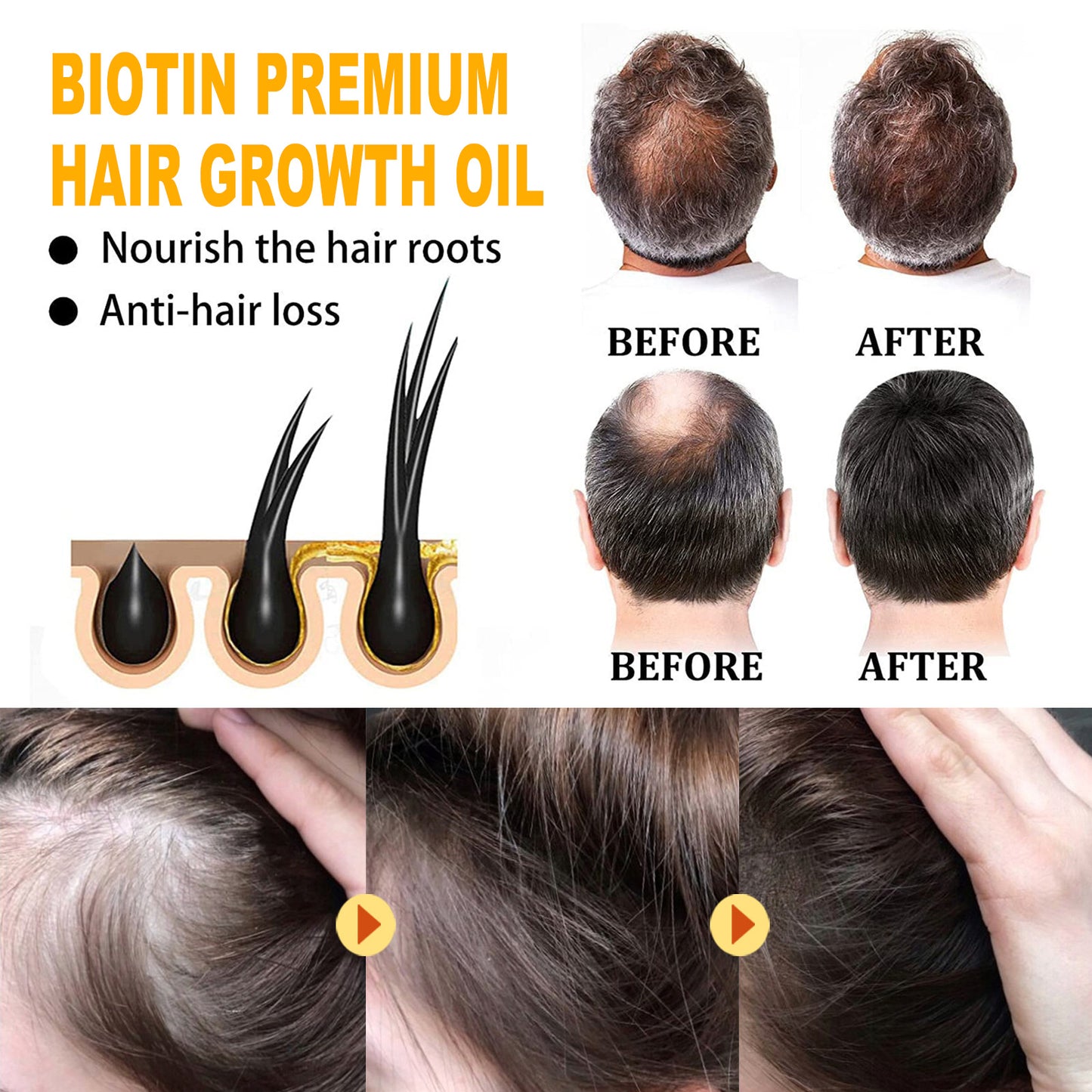 EELHOE Biotin Hair Oil – Moisturizing & Smoothing