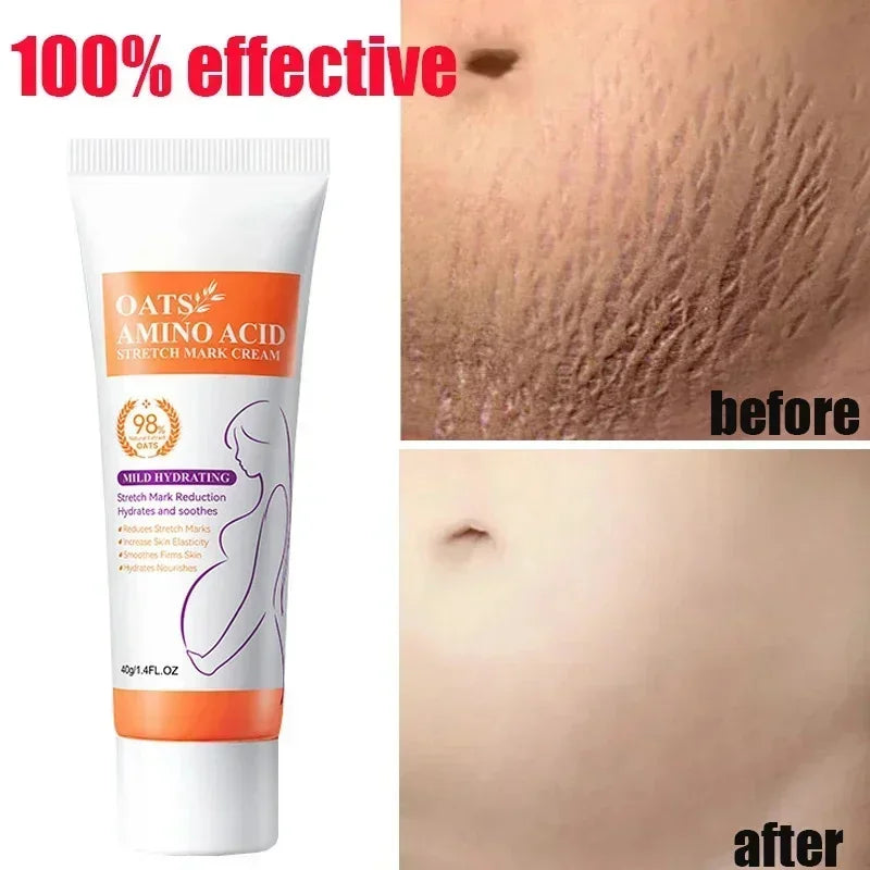 Stretch Mark & Firming Body Cream – Repair & Anti-Aging Care