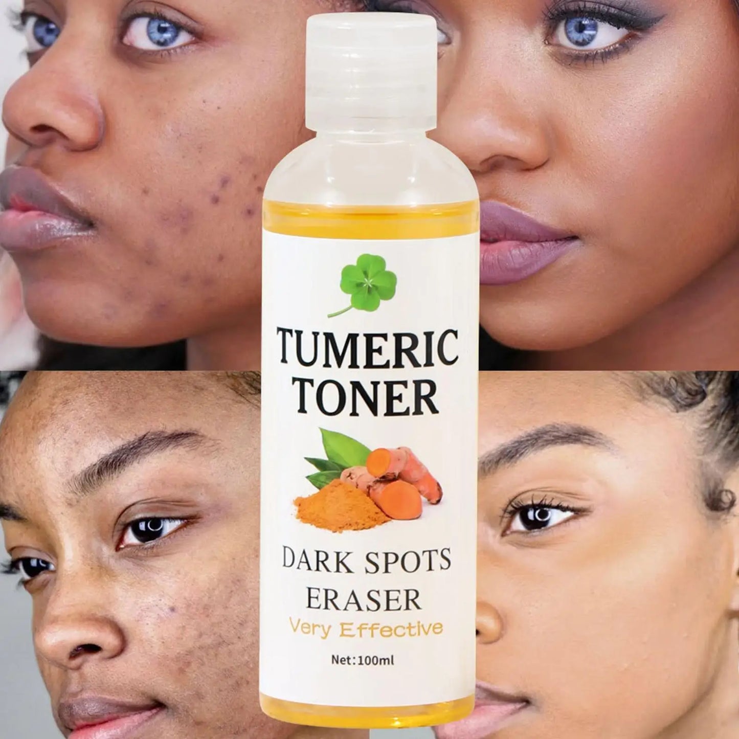 Turmeric Facial Toner – Dark Spot Remover