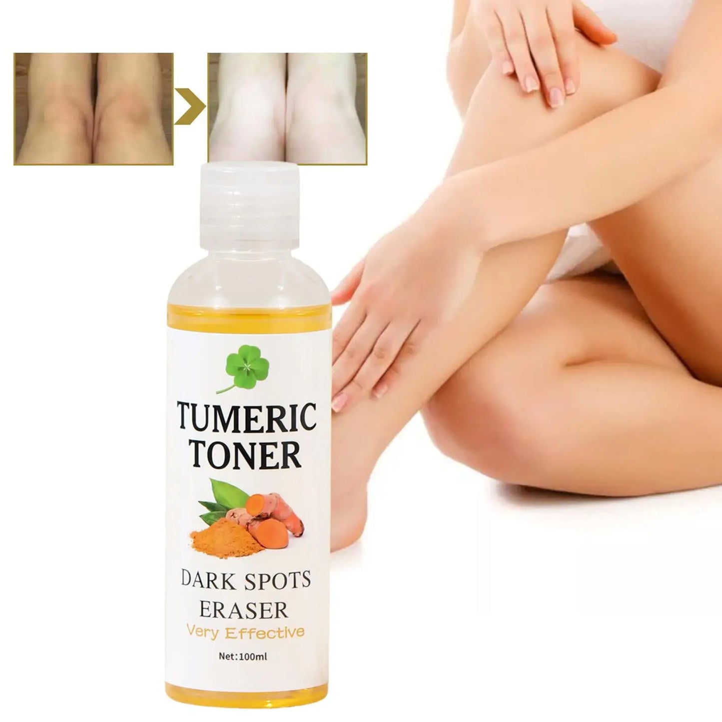 Turmeric Facial Toner – Dark Spot Remover