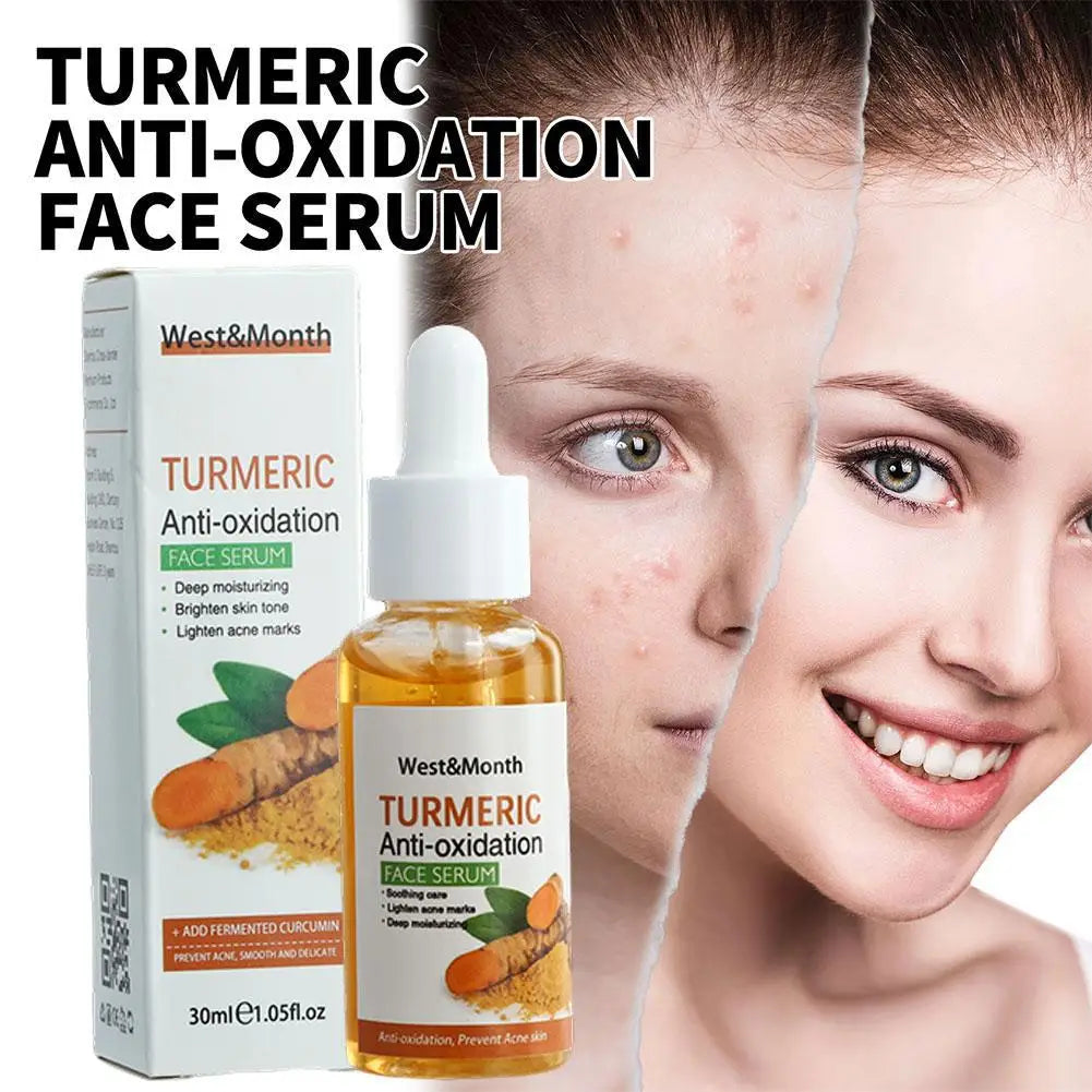 Turmeric Face Serum – Dark Spot Corrector & Brightening Oil (1/2/3PCs)