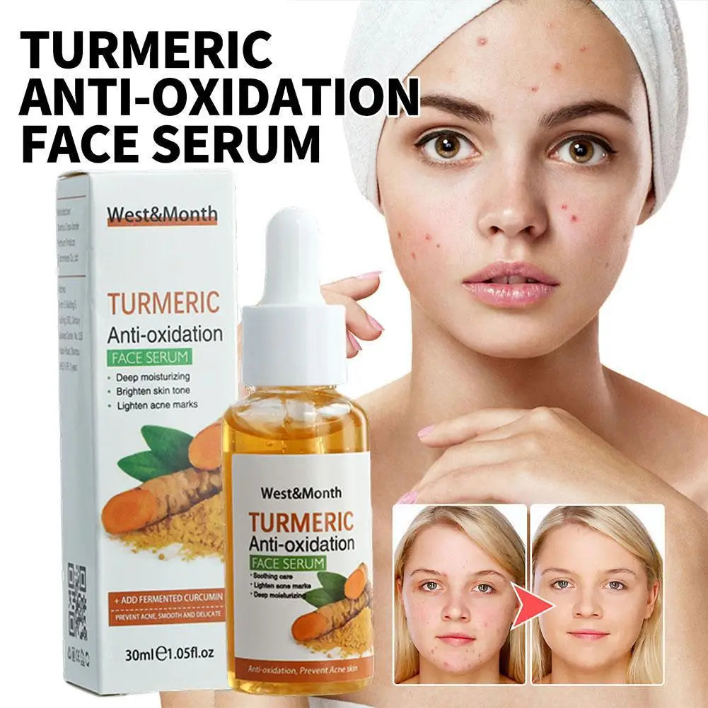 Turmeric Face Serum – Dark Spot Corrector & Brightening Oil (1/2/3PCs)