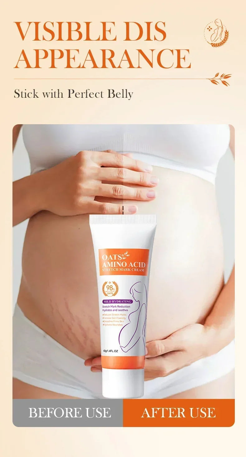 Stretch Mark & Firming Body Cream – Repair & Anti-Aging Care