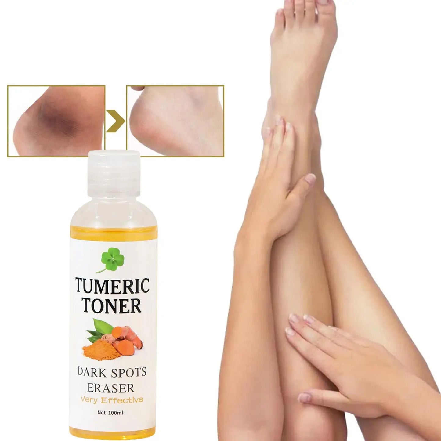 Turmeric Facial Toner – Dark Spot Remover